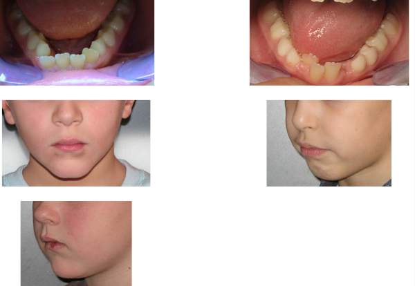 Orthodontie Orléans